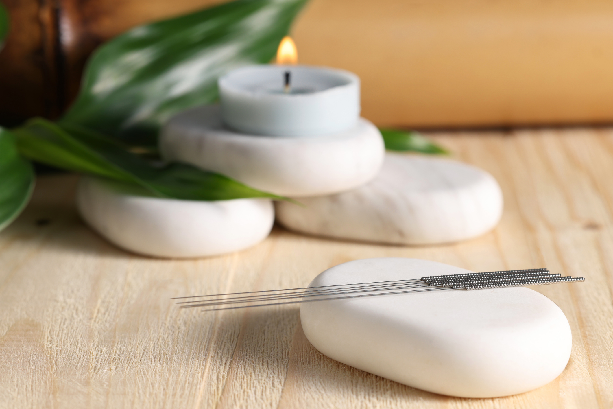 Acupuncture treatment at Chang AcuBalance